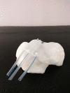 Fig. 2