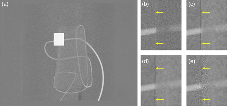 Fig. 21