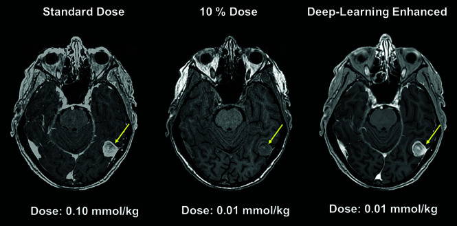 Fig 4.