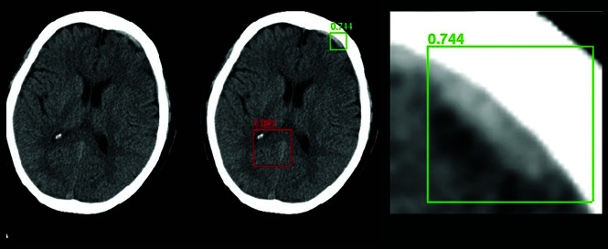 Fig 2.