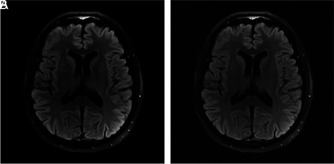 Fig 3.