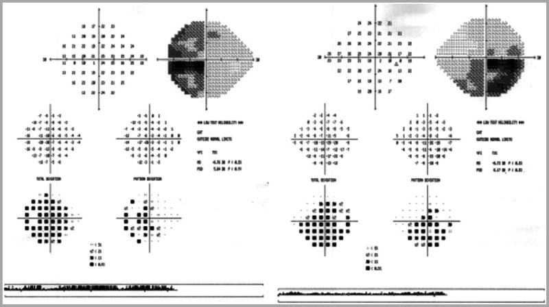 Figure 5-6.