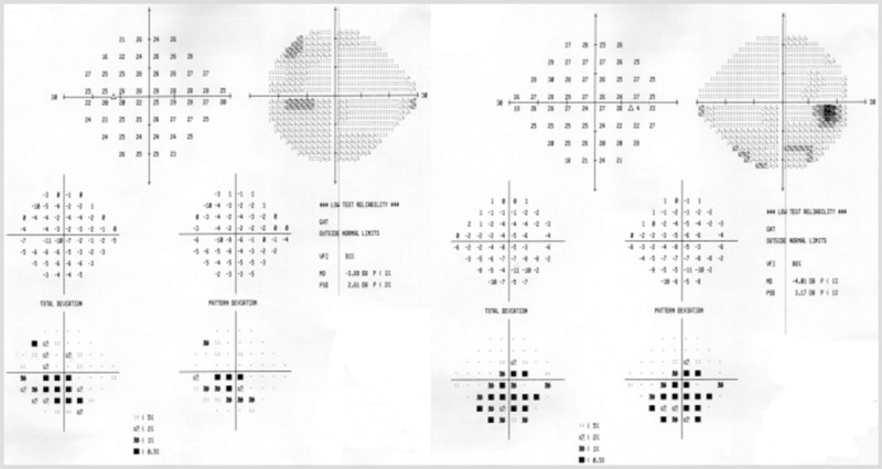 Figure 5-7.