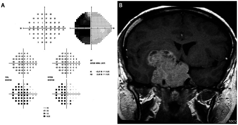 Figure 5-12.