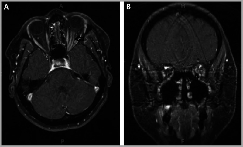 Figure 5-16.