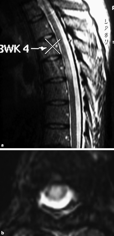 graphic file with name 67899_3_De_32_Fig7_HTML.jpg