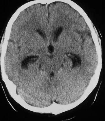 graphic file with name 67899_3_De_32_Fig2_HTML.jpg