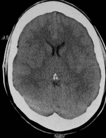 graphic file with name 67899_3_De_32_Fig1_HTML.jpg