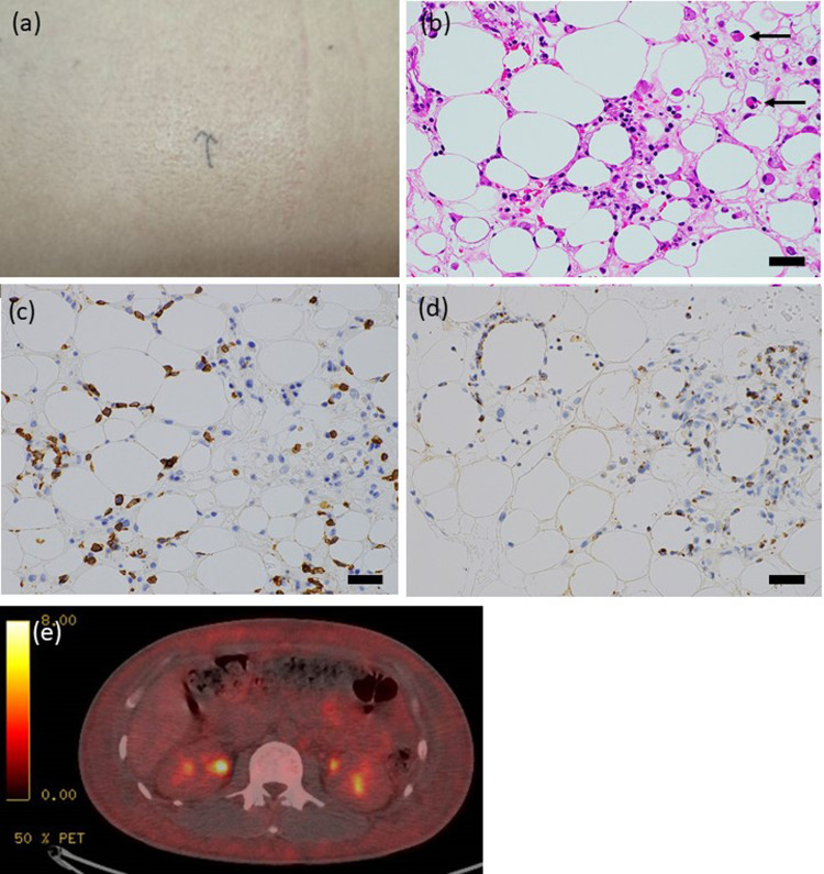 Fig. 1. (a)