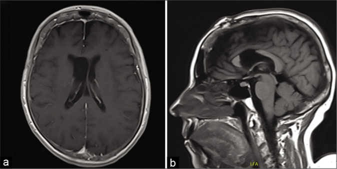 Figure 2: