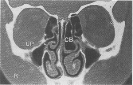 FIG 6