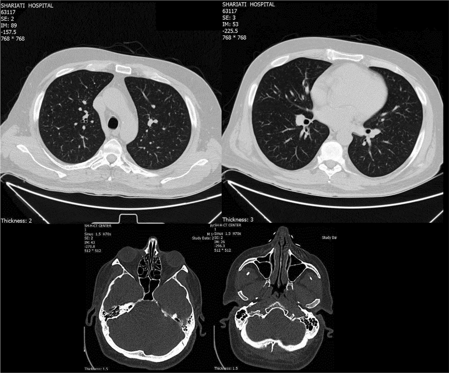 Fig. 2