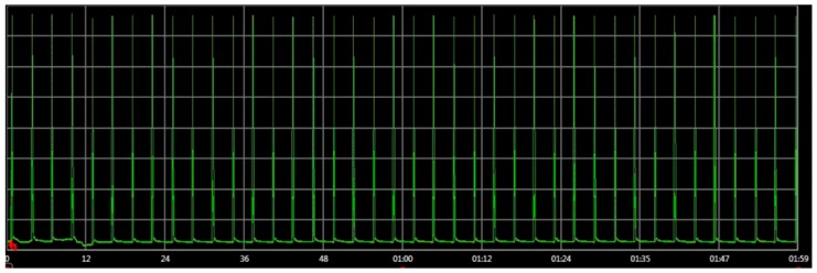 graphic file with name sensors-16-01932-i002.jpg