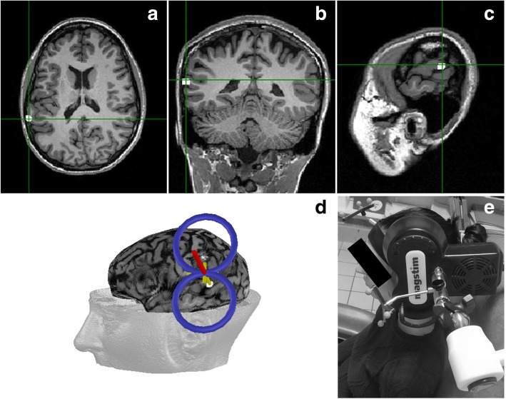 Fig. 3