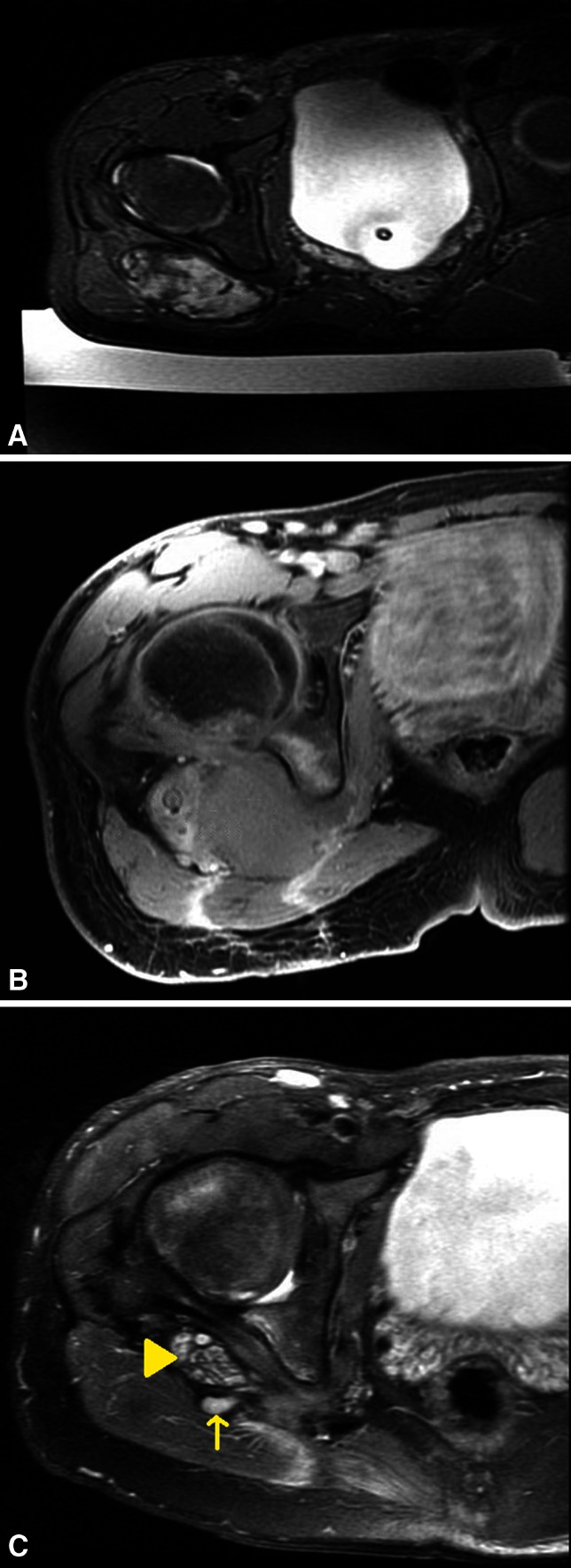 Fig. 3A–C