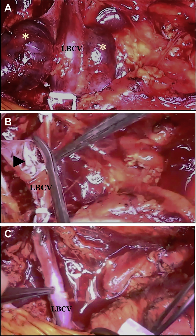 Fig 2