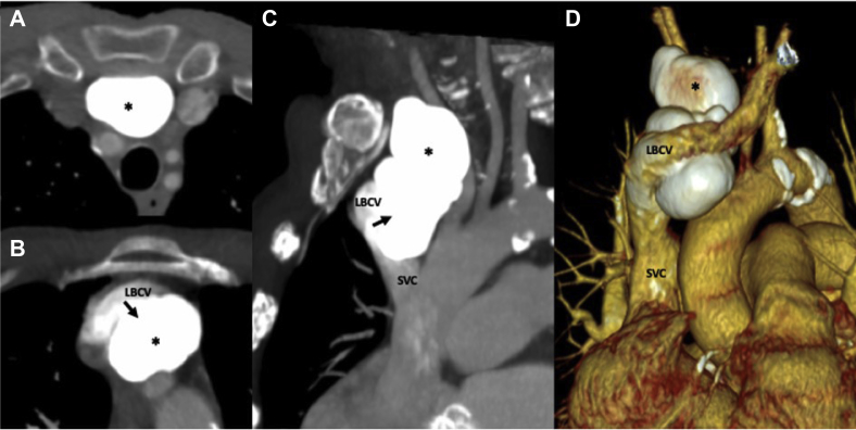 Fig 1