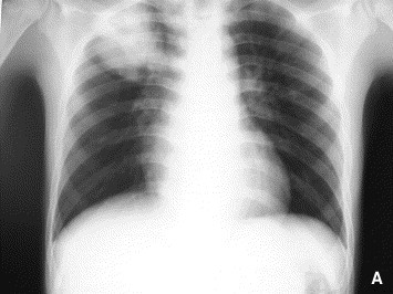 Fig. 2