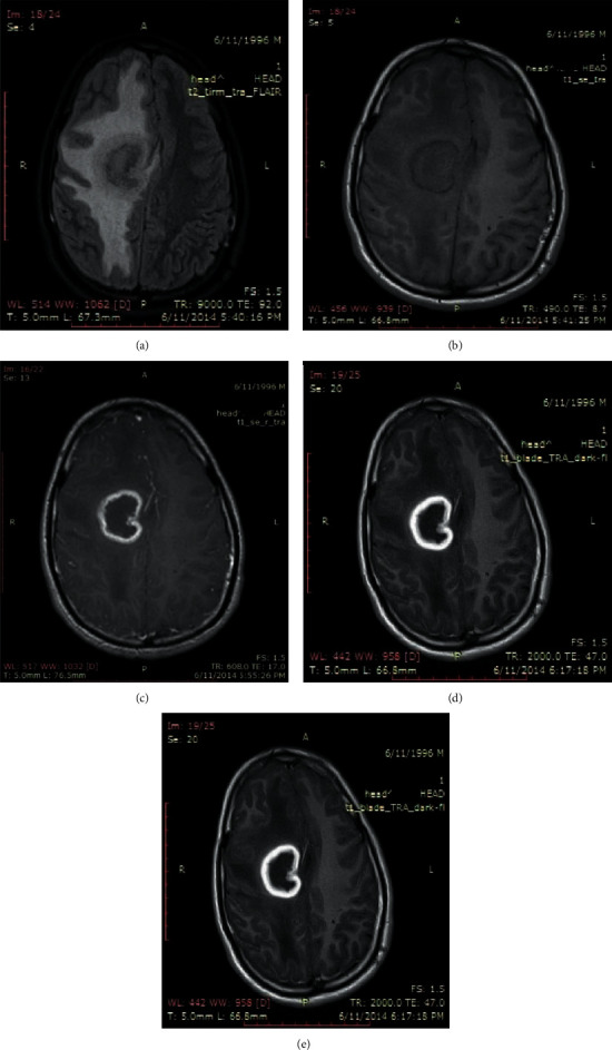 Figure 5