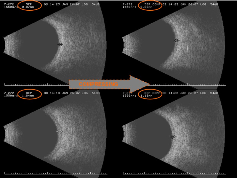 FIGURE 11