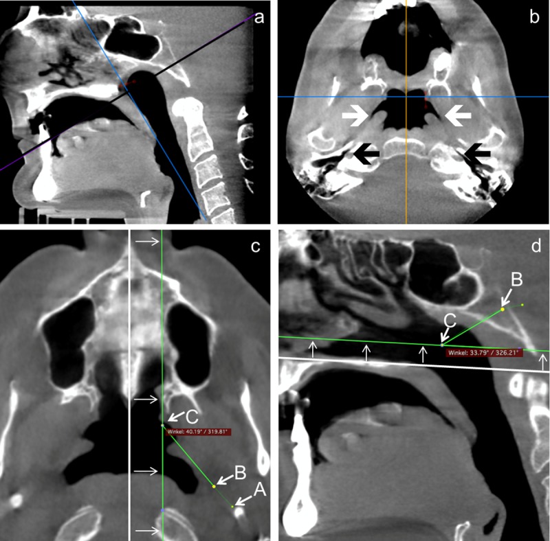 Fig 2