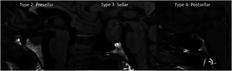 FIG 1.