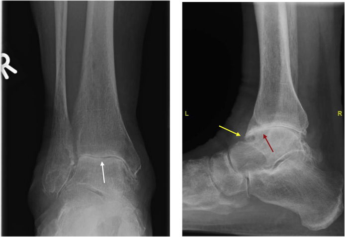 Fig. 2