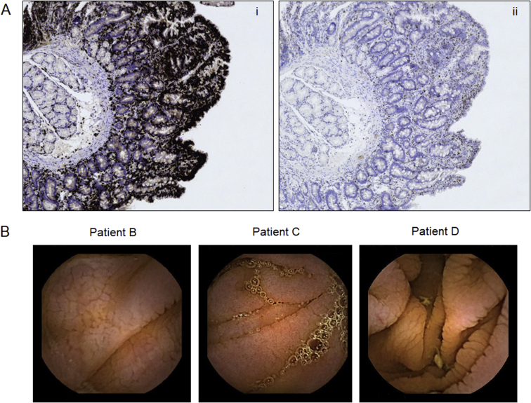 Fig E3