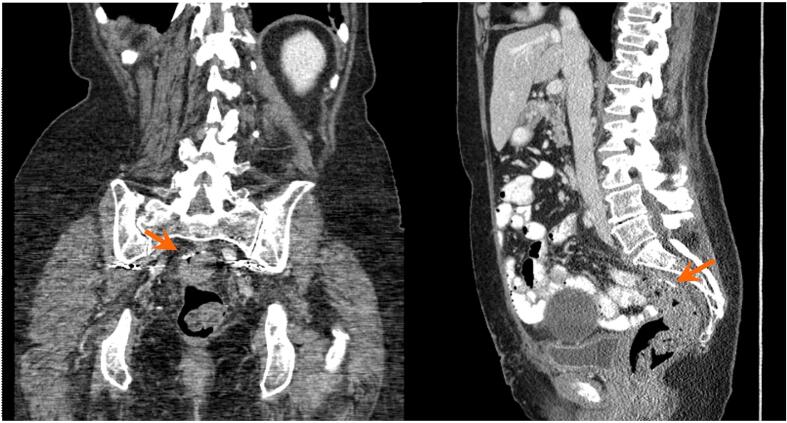 Fig. 1d