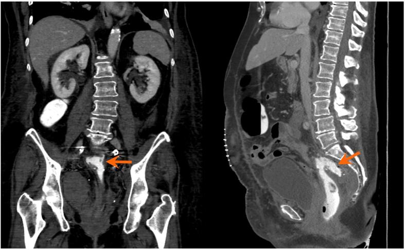 Fig. 1b