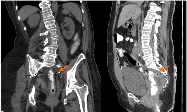 Fig. 1c