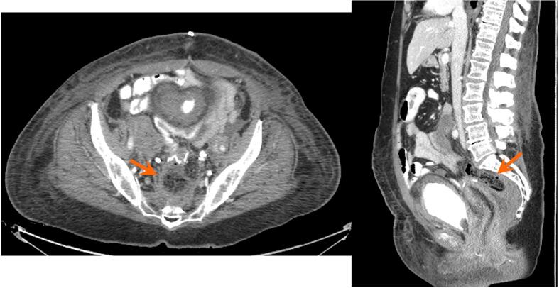 Fig. 1a