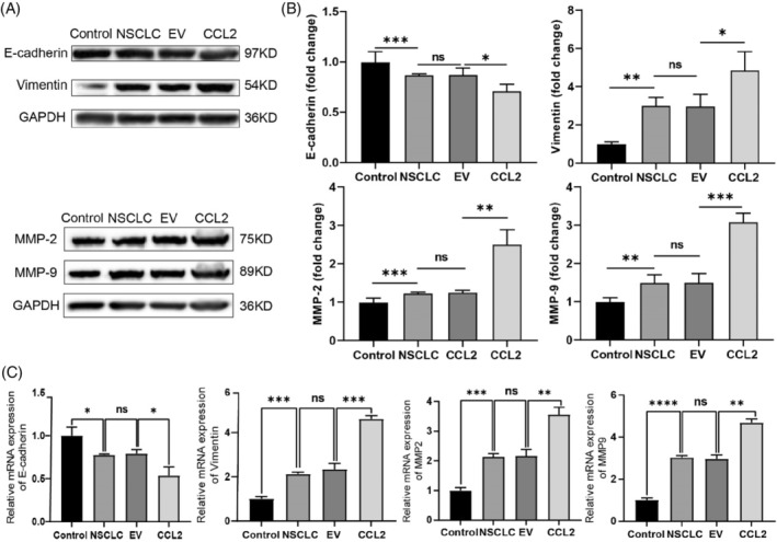 CCL2 promotes metastasis and epithelial–mesenchymal transition of non ...