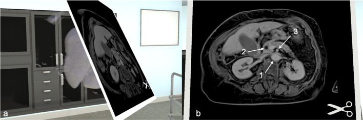 Fig. 3