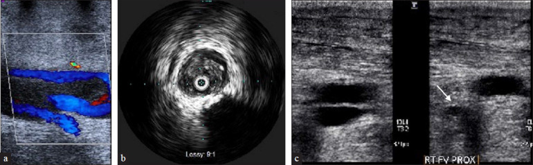 Figure 3: