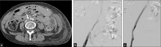 Figure 11: