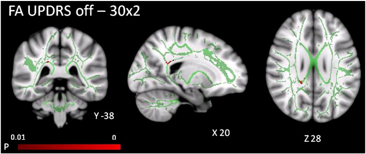 Fig. 2