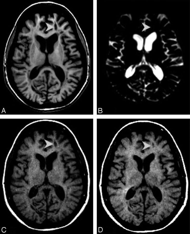 Fig 2.