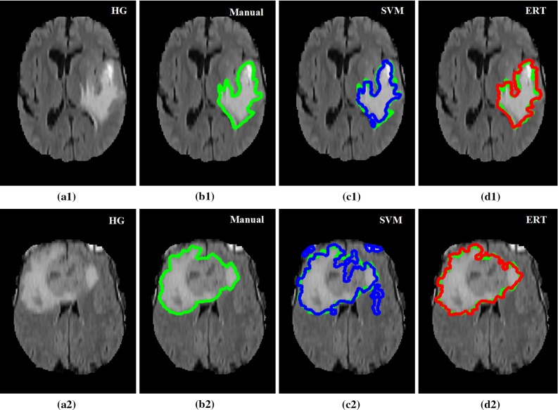 Fig. 14