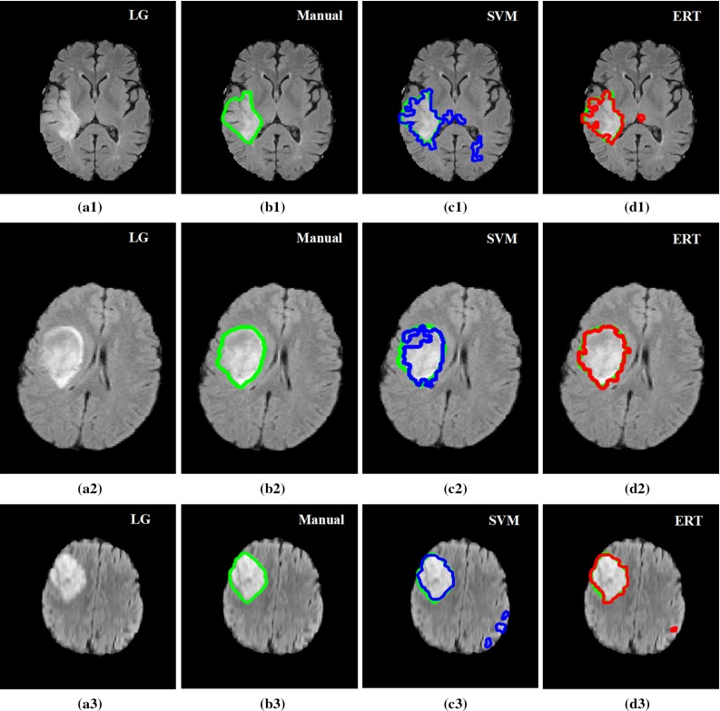 Fig. 15