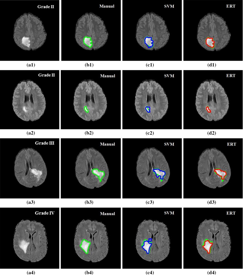 Fig. 12