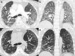 Fig. 14