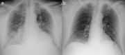 Fig. 13