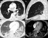 Fig. 15