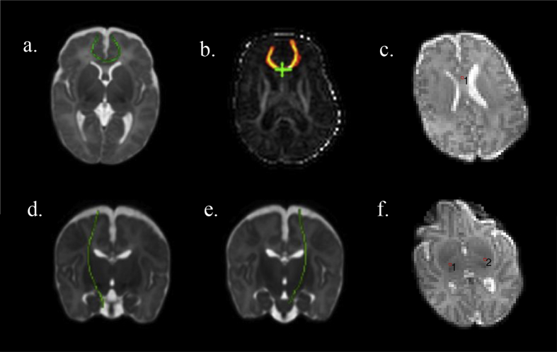 Fig. 1