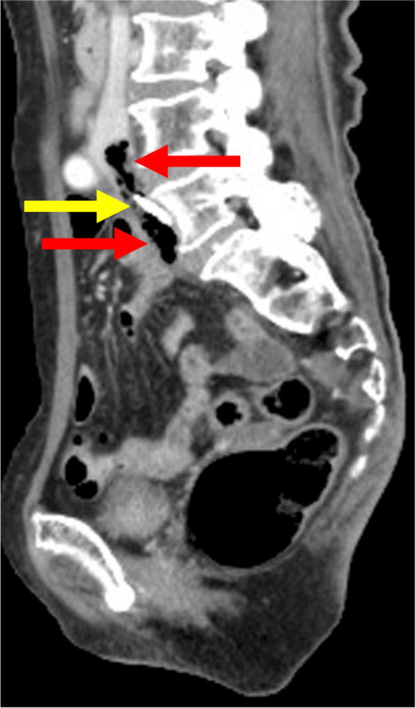 Fig. 2