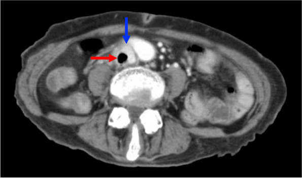 Fig. 1