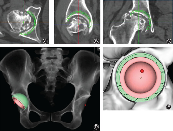 Fig. 1