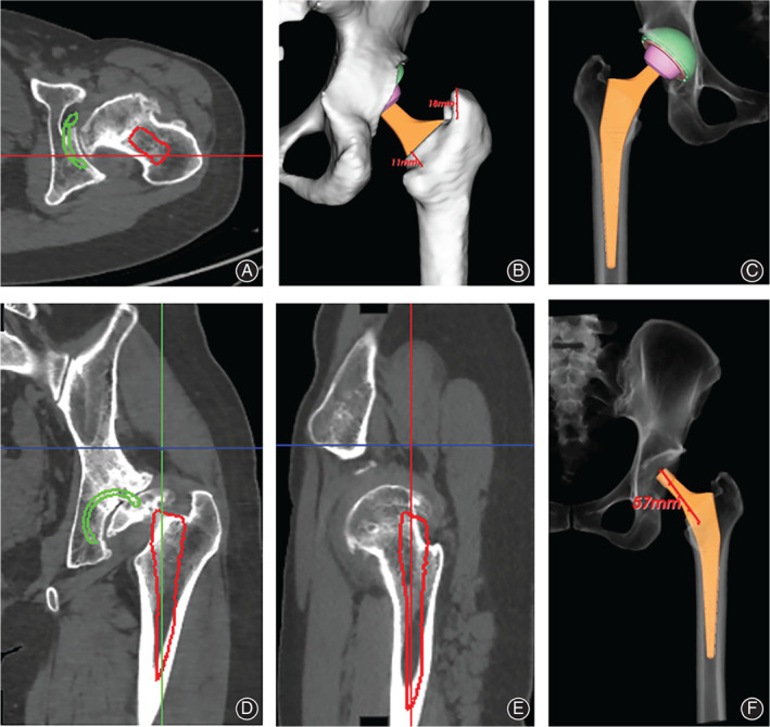 Fig. 2