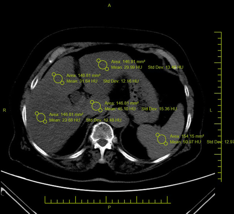 FIGURE 1